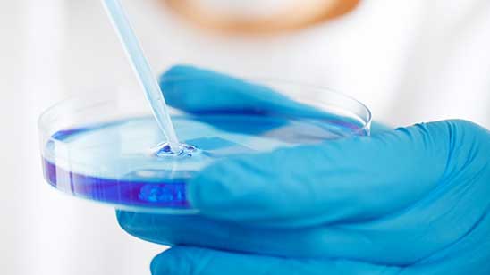 Lassa Fever in Nigeria