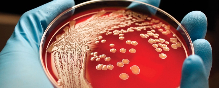 Antimicrobicoresistenza: problemi attuali e impegno per il futuro